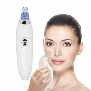 DermaSuction vákuumos mitesszer eltávolító és pórus tisztító - Mert a tökéletes arcbőr mindenkinek jár! kép