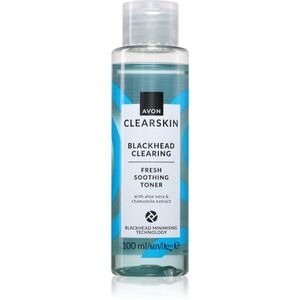 Avon Clearskin Blackhead Clearing tisztító arcvíz a mitesszerek ellen 100 ml kép