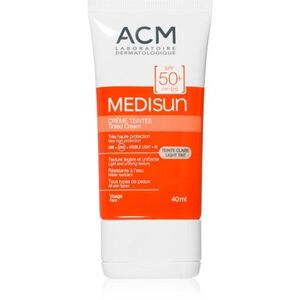 ACM kép