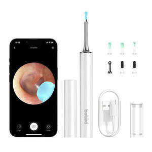 Bebird T15 Smart Visual Otoszkóp - Fehér kép