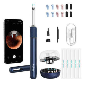 Bebird Note 5 Pro Otoszkóp - Fültisztító Kamera kép