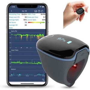 O2Ring kép