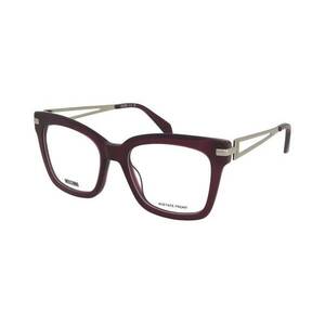 Moschino Moschino MOS668 B3V kép