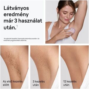 BRAUN SILK-EXPERT IPL PL1100 VILLANÓFÉNYES SZŐRTELENÍTŐ kép
